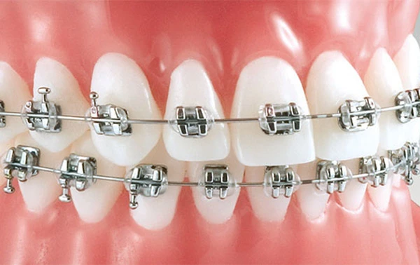 imagen dental