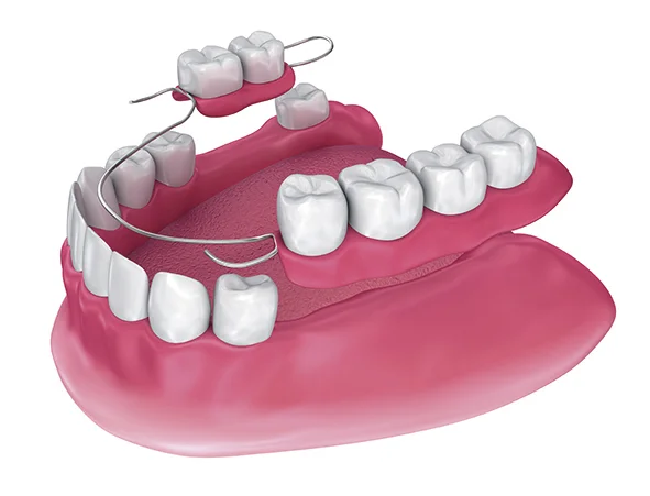 imagen dental